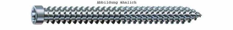 ABC-Spax Rahmenanker, für Holzprofil, 7,5 x 120 mm, VPE 100